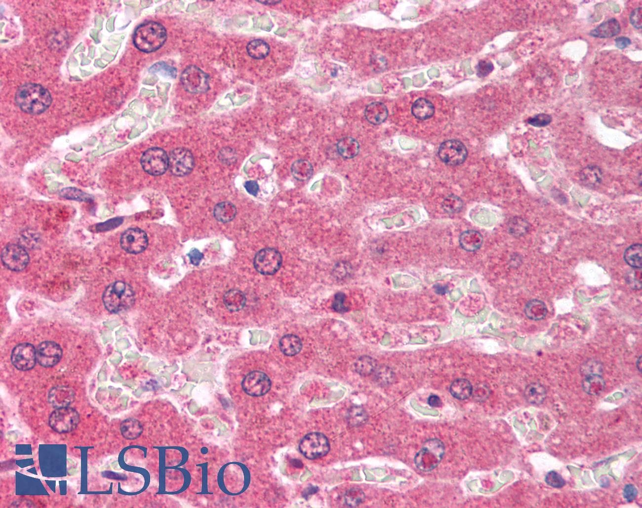 IHC-plus™ Monoclonal Mouse GST / Glutathione S-Transferase Antibody (clone 3G10, aa1-425, IHC, IF, WB)