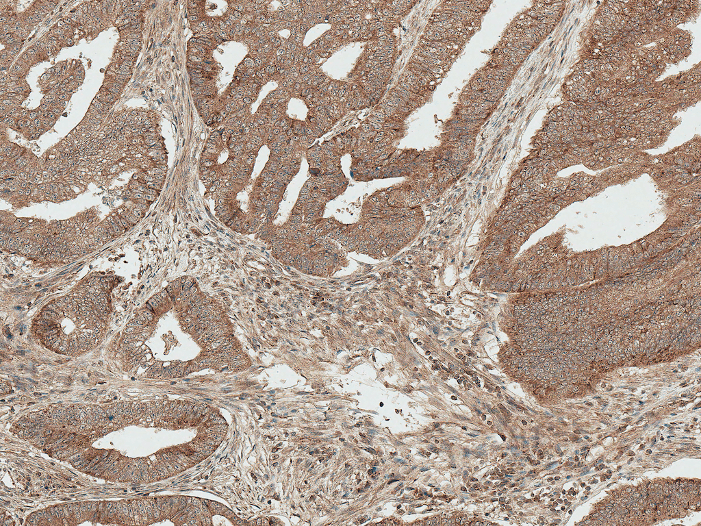 BCL2 / Bcl-2 Antibody (PerCP)