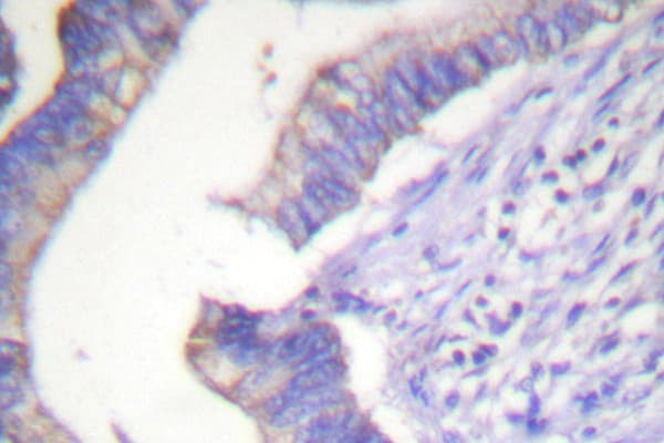 BCL2 / Bcl-2 Antibody (Pro65)
