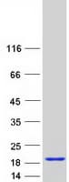 Human ZNF593 Protein (Recombinant Myc-DDK (Flag))