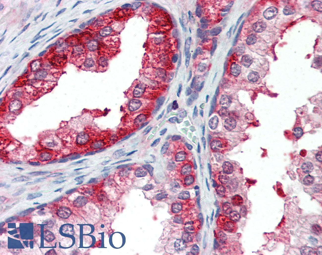 IHC-plus™ SKP2 Antibody (aa221-425)