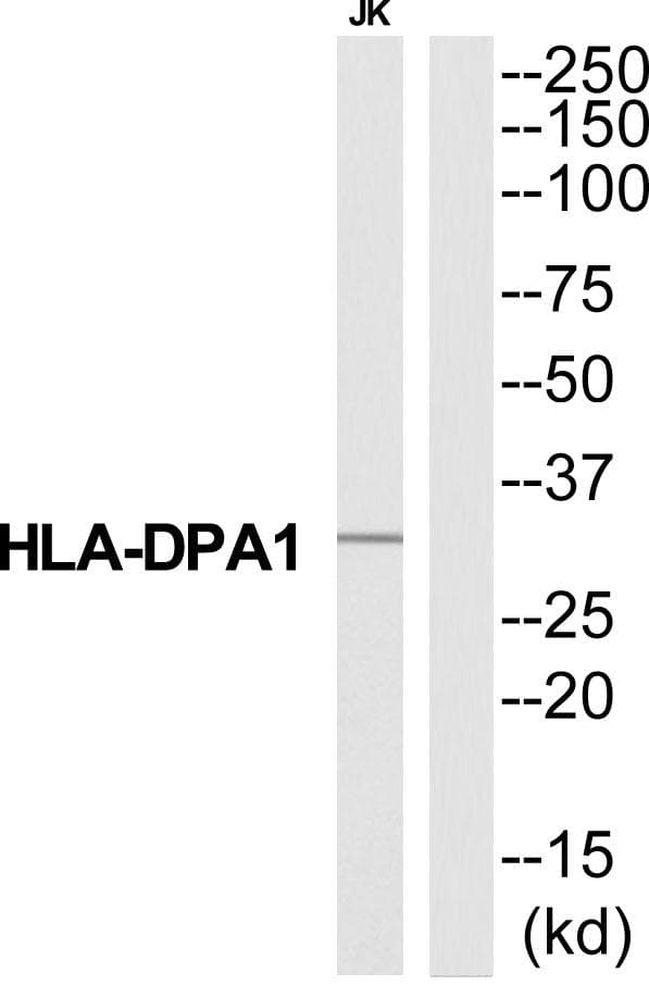 Polyclonal Rabbit anti-Human HLA-DPA1 Antibody (WB)