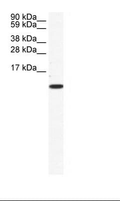 CCL5 / RANTES Antibody (aa26-75, FITC)