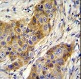 ANKRD39 Antibody (aa137-165)