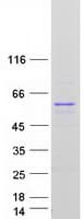 Human NR1A2 / THRB Protein (Recombinant Myc-DDK (Flag))