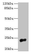 Polyclonal Rabbit anti-Human NACA2 Antibody