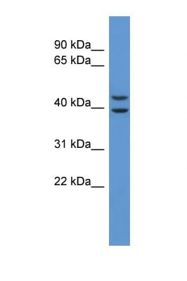 ADORA3 / Adenosine A3 Receptor Antibody (aa247-296)