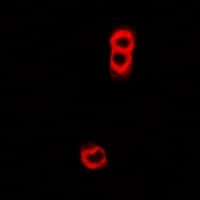 TAP2 Antibody