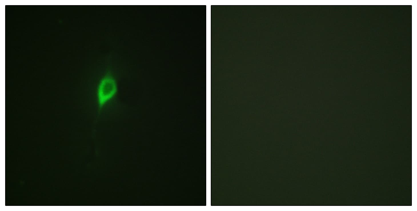 EIF4B Antibody (phospho-Ser422)