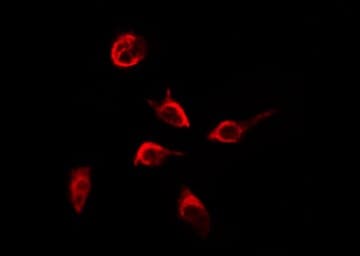 ITGB4 / Integrin Beta 4 Antibody