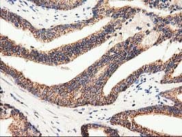 CLPP Antibody (clone OTI1F6, Carrier-free)