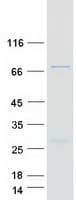Human GRHL2 Protein (Recombinant Myc-DDK (Flag))