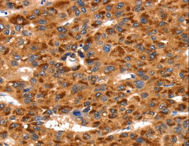 TLN1 / Talin 1 Antibody