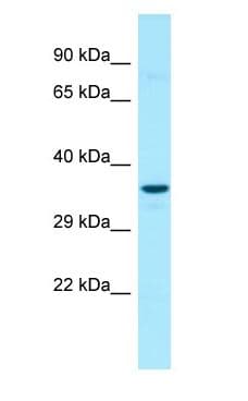 SCN4 / G6PC3 Antibody (aa86-135)