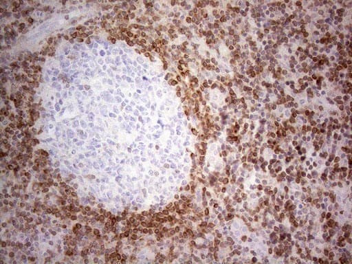 BCL2 / Bcl-2 Antibody (clone UMAB225)