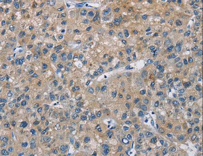 CAB39L Antibody