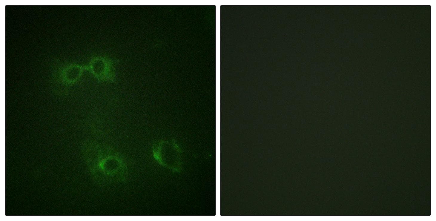 CD95 / FAS Antibody (phospho-Tyr291)