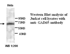 GAD65 Antibody