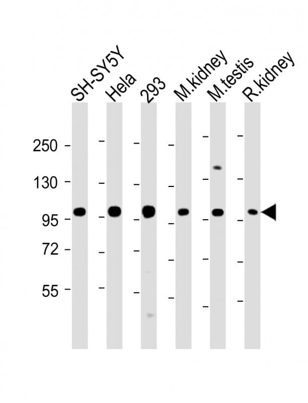 IHC-plus™ Polyclonal Rabbit anti-Human PGAP1 Antibody (N-Terminus, IHC, IF, WB)