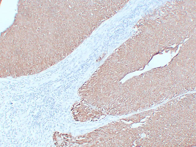 IHC-plus™ Monoclonal Mouse anti-Human KRT7 / CK7 / Cytokeratin 7 Antibody (clone ABT-CK7, IHC, WB)