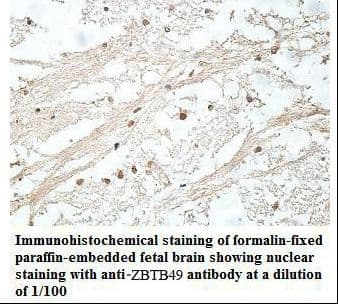 Polyclonal Rabbit anti-Human ZNF509 / ZBTB49 Antibody (aa441-637, IHC, WB)