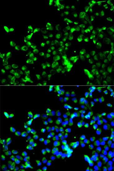 Polyclonal Rabbit anti-Human CALR / Calreticulin Antibody (IHC, IF, WB)