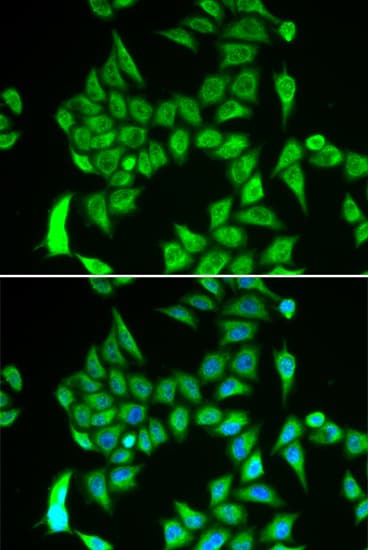 IREB2 / IRP2 Antibody