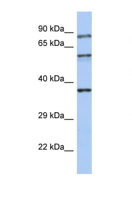 Polyclonal Rabbit anti-Human RPH3A / Rabphilin 3A Antibody (aa35-84, WB)
