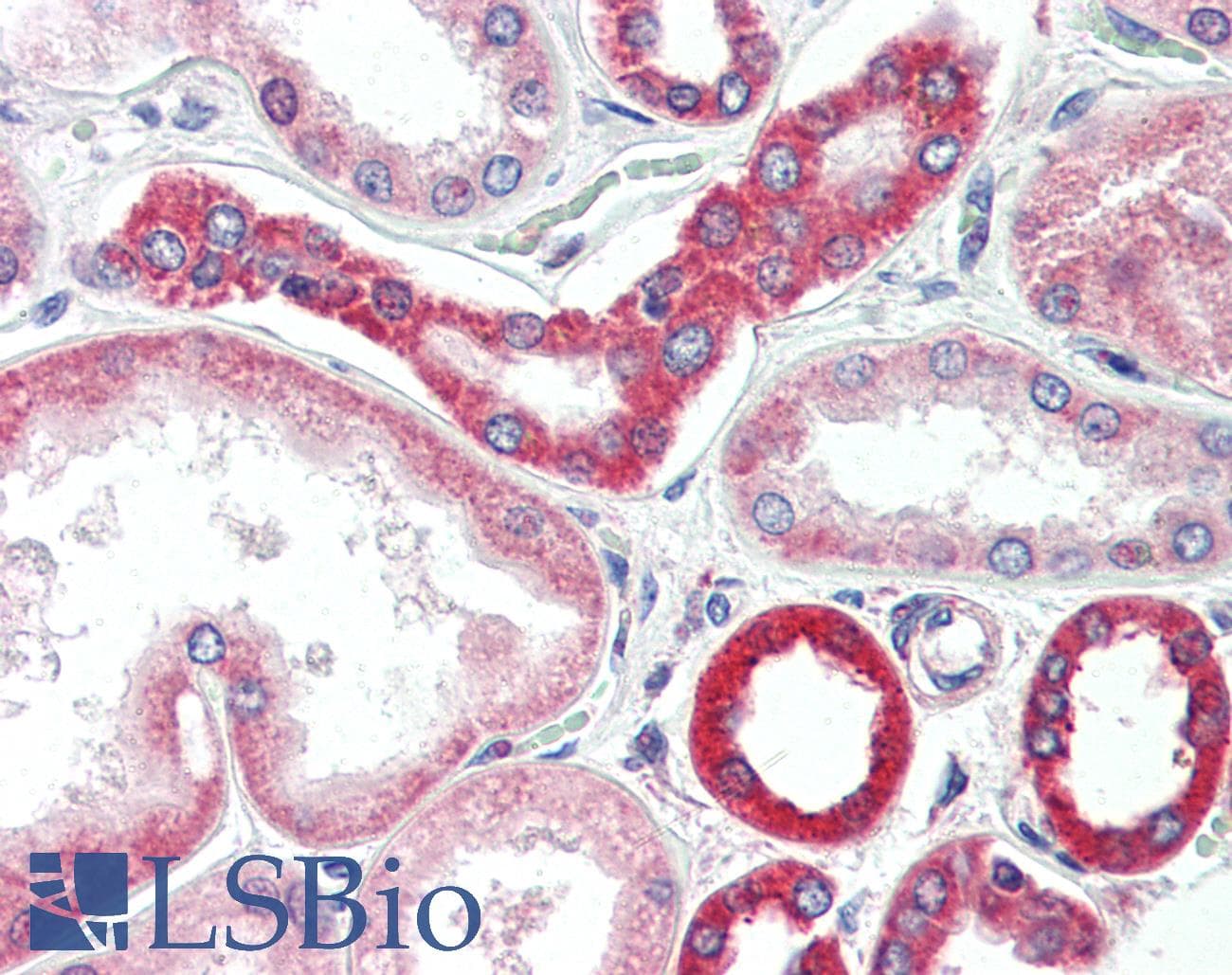 IHC-plus™ Polyclonal Rabbit anti-Human BAK1 / BAK Antibody (IHC, IF, WB)