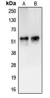 IHC-plus™ Polyclonal Rabbit anti-Human CAMKV Antibody (Internal, IHC, WB)