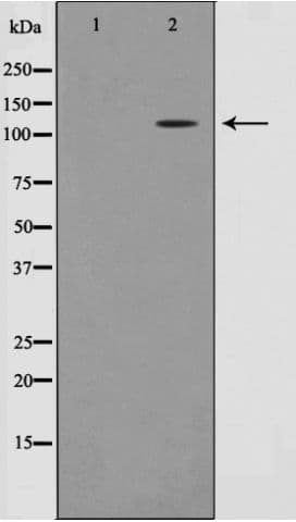 RB1 / Retinoblastoma / RB Antibody (phospho-Thr826)