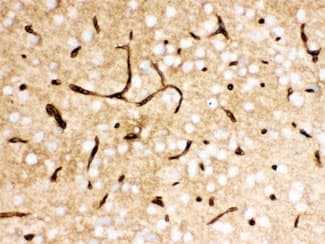 SLC2A1 / GLUT-1 Antibody (aa92-492)