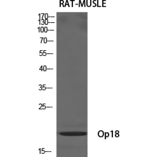 Polyclonal Rabbit anti-Human STMN1 / Stathmin / LAG Antibody (1-80 aa, IHC, IF, WB)