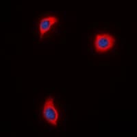 AKAP1 / AKAP Antibody (aa286-325)