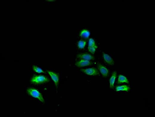 Polyclonal Rabbit anti-Human FADS1 Antibody (IHC, IF)