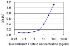 IHC-plus™ SIPR3 / EDG3 / S1P3 Antibody (clone 2G11)
