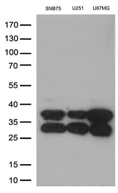 CTSL / Cathepsin L Antibody (aa114-333, clone OTI5C8)