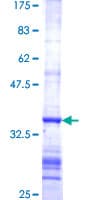 Human FDXR Protein (Recombinant GST, N-terminus)