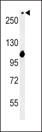 NOTCH3 Antibody (aa2291-2321)