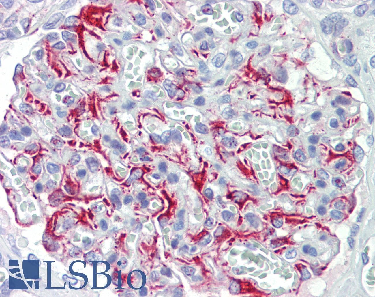 IHC-plus™ FGF11 / FGF-11 Antibody (aa1-30)