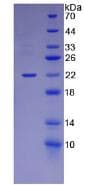 Mouse LAMA1 / Laminin Alpha 1 Protein (Recombinant His)