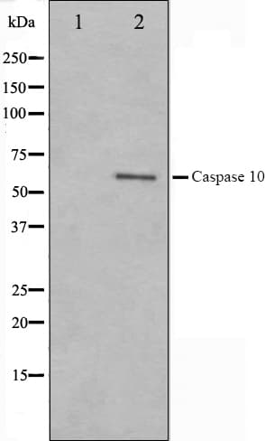 Polyclonal Rabbit anti-Human CASP10 / Caspase 10 Antibody (IHC, IF, WB)