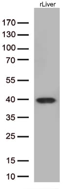 ARG1 / Arginase 1 Antibody (clone OTI4H7)