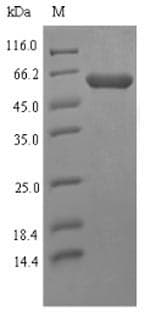 Mycoplasma hyorhinis p37 Protein (Recombinant 6His-SUMO, N-terminus)