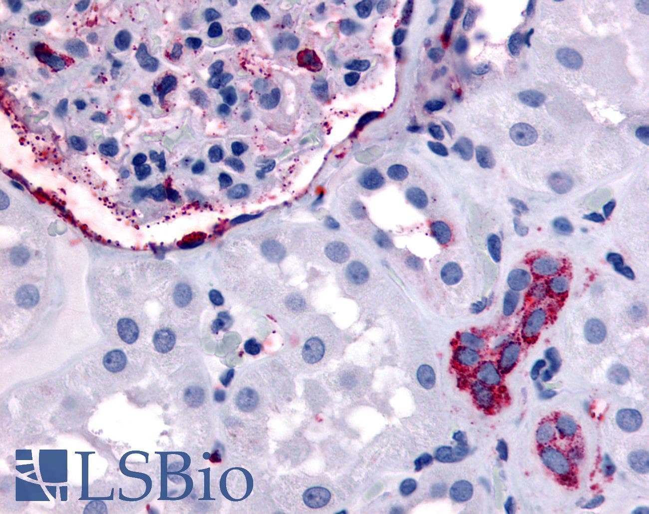 IHC-plus™ Polyclonal Rabbit anti-Human ERBB4 / HER4 Antibody (Internal, IHC)