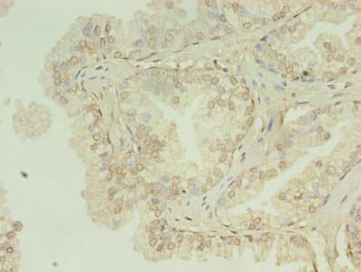Polyclonal Rabbit anti-Human HNRNPL / hnRNP L Antibody (aa89-335, IHC)