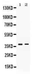 TNFRSF14 / CD270 / HVEM Antibody