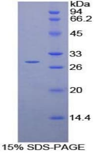 Rat VWA1 / WARP Protein (Recombinant His-T7)