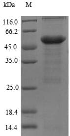 Human MYBPC3 / MYBP-C Protein (Recombinant 6His-SUMO, N-terminus)