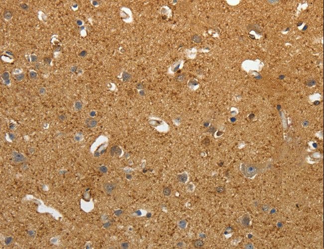 Gravin / AKAP12 Antibody